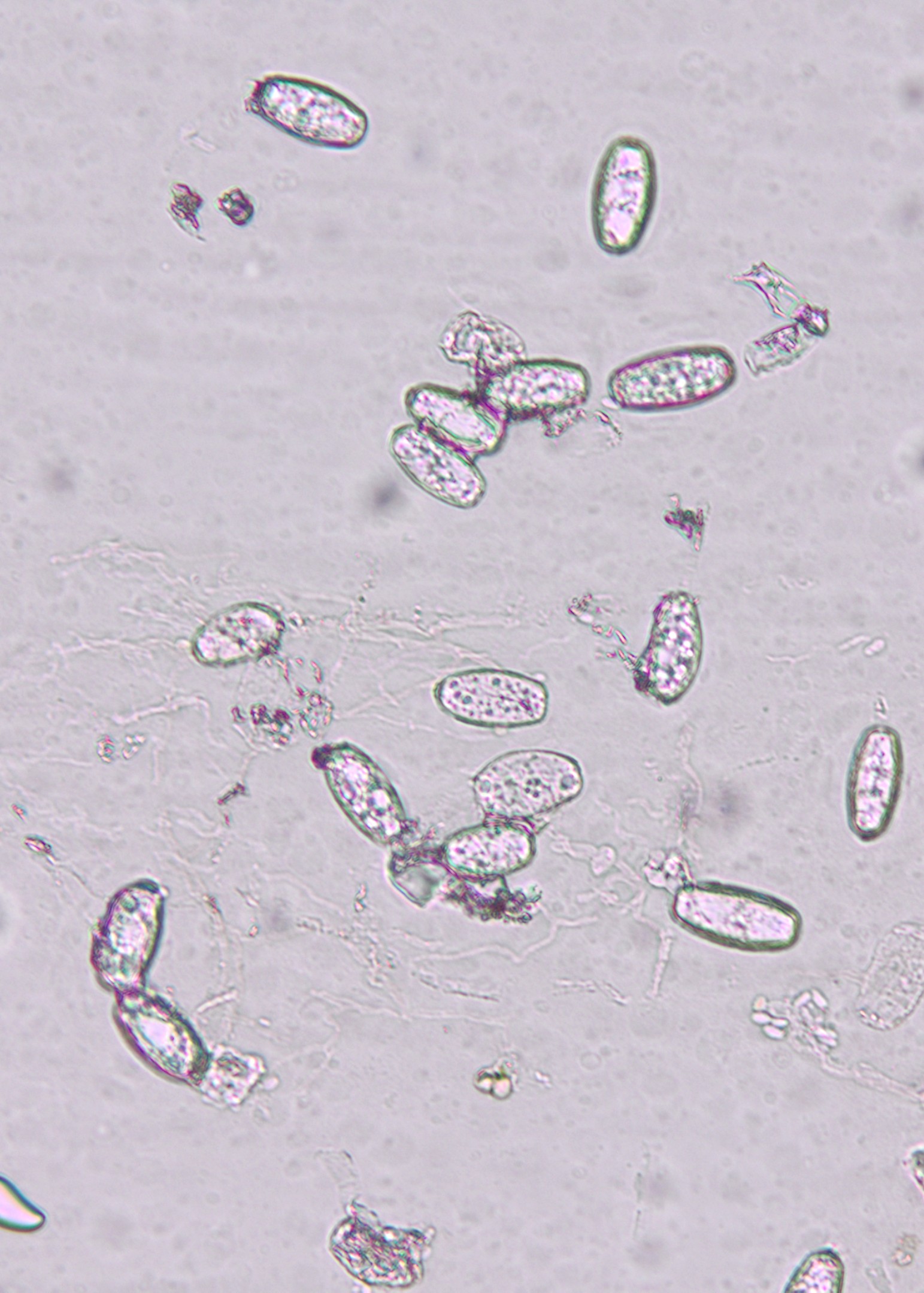 Oak Podosphaera conidia.jpg